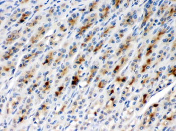 TCP1 beta/CCT2 Rabbit Polyclonal Antibody