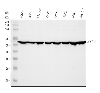 TCP1 beta/CCT2 Rabbit Polyclonal Antibody