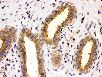 TCP1 theta/CCT8 Rabbit Polyclonal Antibody