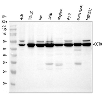 TCP1 theta/CCT8 Rabbit Polyclonal Antibody