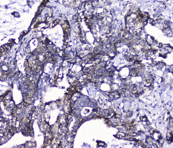 Cdk6 Rabbit Polyclonal Antibody