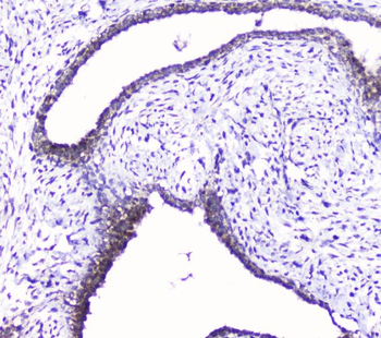 Cdk6 Rabbit Polyclonal Antibody