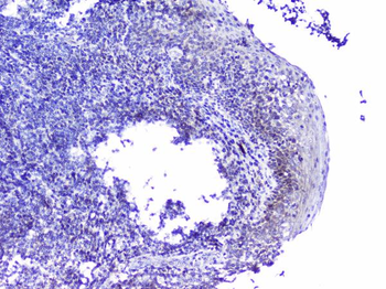 Cdk6 Rabbit Polyclonal Antibody
