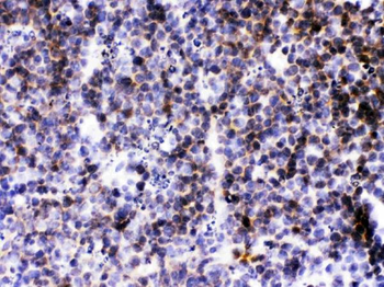 BCA1/CXCL13 Rabbit Polyclonal Antibody