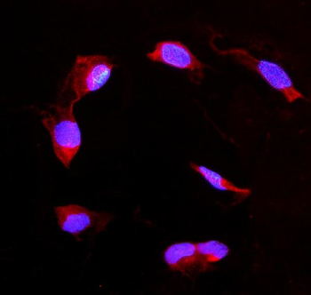 DDAH2 Rabbit Polyclonal Antibody