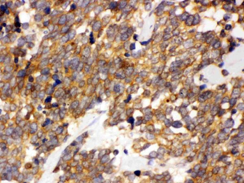 DDAH2 Rabbit Polyclonal Antibody