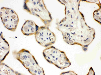 DDAH2 Rabbit Polyclonal Antibody