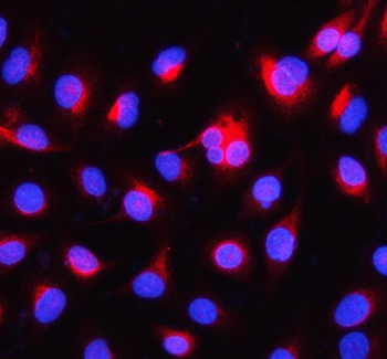 Alpha Internexin/INA Rabbit Polyclonal Antibody