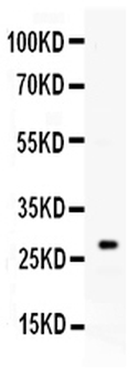 Kallikrein 8/KLK8 Rabbit Polyclonal Antibody