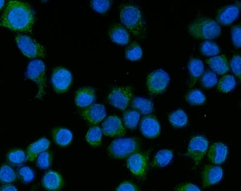 TAK1/MAP3K7 Rabbit Polyclonal Antibody