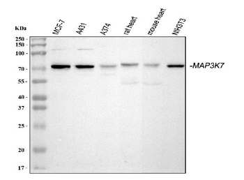 TAK1/MAP3K7 Rabbit Polyclonal Antibody