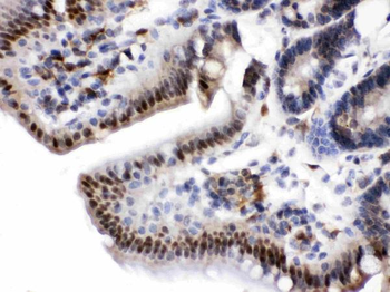 Visfatin/NAMPT Rabbit Polyclonal Antibody
