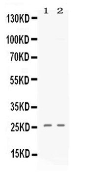 PF4 Rabbit Polyclonal Antibody