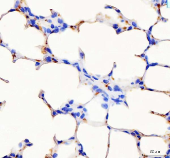 PF4 Rabbit Polyclonal Antibody