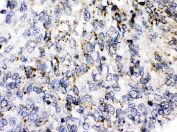 Perilipin 3/PLIN3 Rabbit Polyclonal Antibody