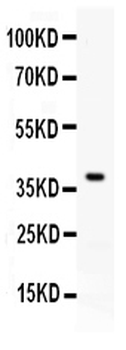 RANKL/TNFSF11 Rabbit Polyclonal Antibody