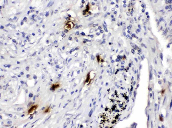 Mast Cell Tryptase/TPSAB1 Rabbit Polyclonal Antibody