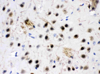ZWINT Rabbit Polyclonal Antibody