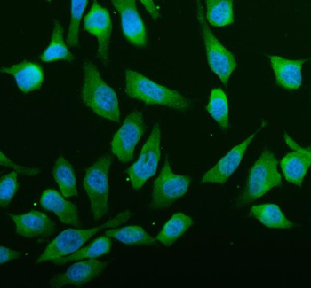 ABCE1 Rabbit Polyclonal Antibody
