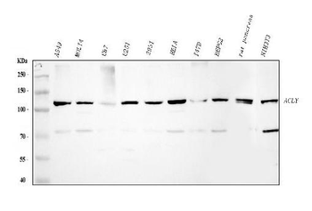 ATP citrate lyase/ACLY Rabbit Polyclonal Antibody