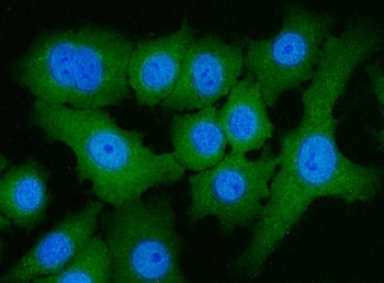 ATP citrate lyase/ACLY Rabbit Polyclonal Antibody