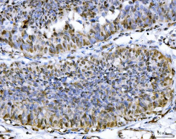 ATP citrate lyase/ACLY Rabbit Polyclonal Antibody