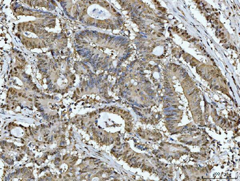 ATP citrate lyase/ACLY Rabbit Polyclonal Antibody