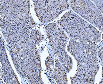 ATP citrate lyase/ACLY Rabbit Polyclonal Antibody