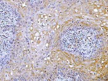 ATP citrate lyase/ACLY Rabbit Polyclonal Antibody