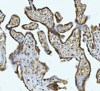 ATP citrate lyase/ACLY Rabbit Polyclonal Antibody