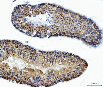 ATP citrate lyase/ACLY Rabbit Polyclonal Antibody