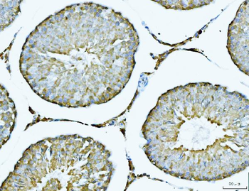 ATP citrate lyase/ACLY Rabbit Polyclonal Antibody