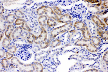 ACSL1 Rabbit Polyclonal Antibody