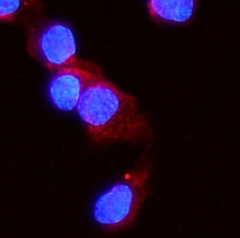 Activin Receptor Type IIA/ACVR2A Rabbit Polyclonal Antibody