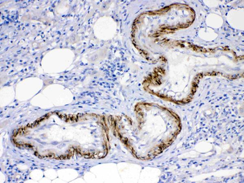 Activin Receptor Type IIA/ACVR2A Rabbit Polyclonal Antibody