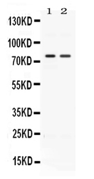 Activin Receptor Type IIA/ACVR2A Rabbit Polyclonal Antibody