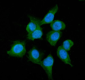 Alcohol Dehydrogenase/ADH1A Rabbit Polyclonal Antibody