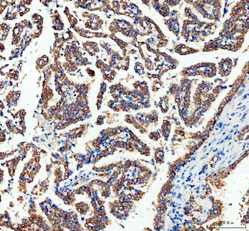 Adenylate Kinase 1/AK1 Rabbit Polyclonal Antibody