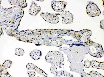 AKR1B1 Rabbit Polyclonal Antibody