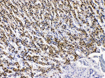 AKR1B1 Rabbit Polyclonal Antibody