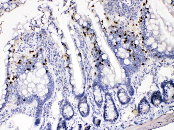 AKR1B1 Rabbit Polyclonal Antibody