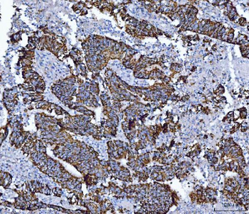 ALDH1B1 Rabbit Polyclonal Antibody