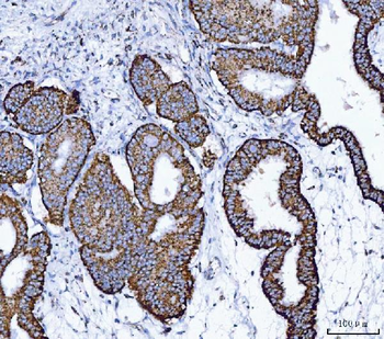 ALDH1B1 Rabbit Polyclonal Antibody