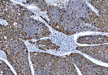 ALDH1B1 Rabbit Polyclonal Antibody