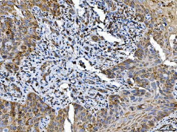 ALDH1B1 Rabbit Polyclonal Antibody