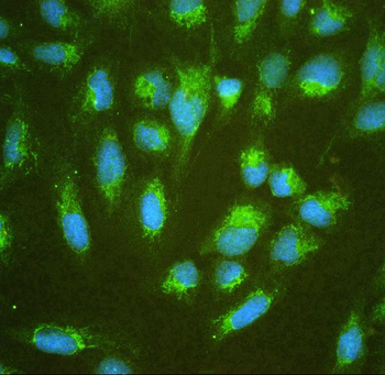 ALDH7A1 Rabbit Polyclonal Antibody