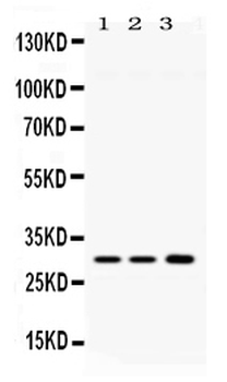 AQP11 Rabbit Polyclonal Antibody