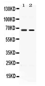 ACCN1/ASIC2 Rabbit Polyclonal Antibody