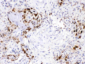 Carbonic Anhydrase III/CA3 Rabbit Polyclonal Antibody