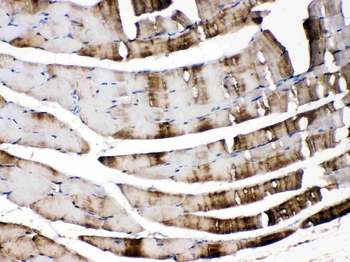 Carbonic Anhydrase III/CA3 Rabbit Polyclonal Antibody